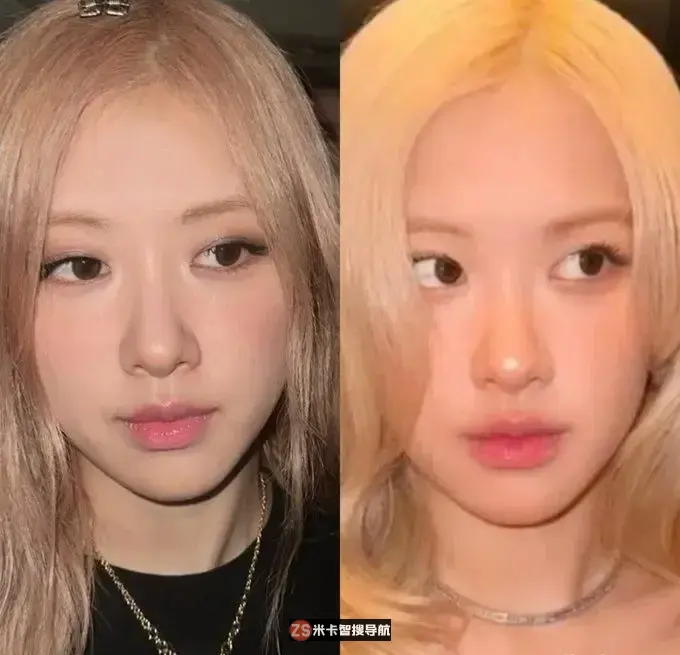 BLACKPINK Rosé疑似割双眼皮手术？网友：”以前比较有魅力”